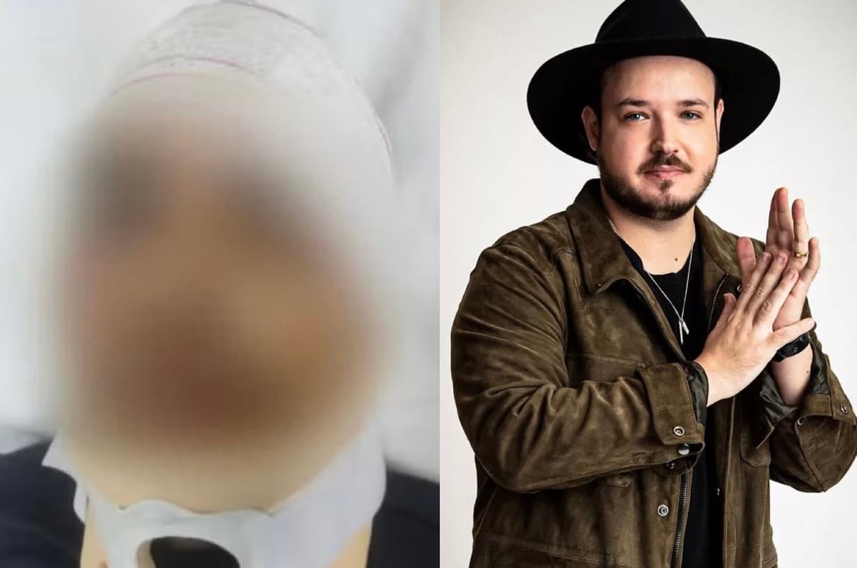 PM do DF é indiciado por atropelar policial que socorria o cantor Israel