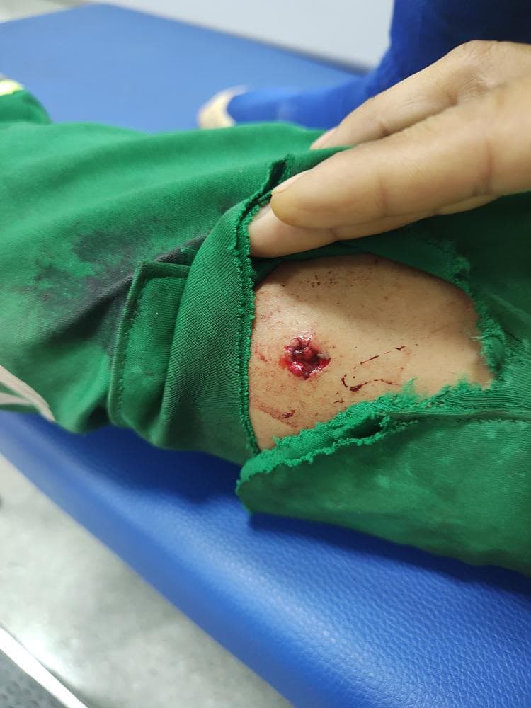 Coletor de lixo leva tiro na perna e ouve deboche de atirador: "Passou em cima de algo, Zé?"