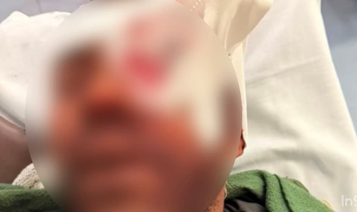 Suspeito atira no olho de homem por dívida de R$ 1,5 mil em Goiânia