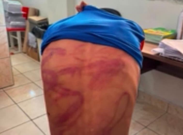 Criança é espancada pelo pai e denuncia ao conselho tutelar; menino é acolhido pela tia