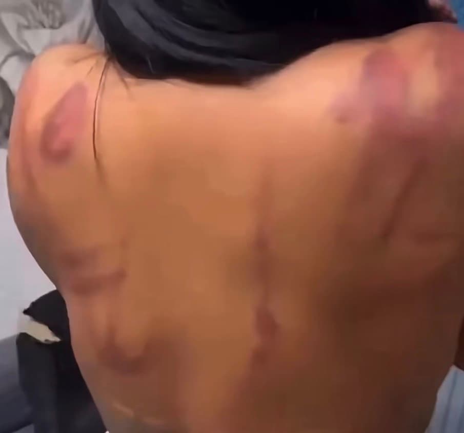 Homem enforca e agride ex-mulher com fio elétrico com a ajuda da mãe e da irmã