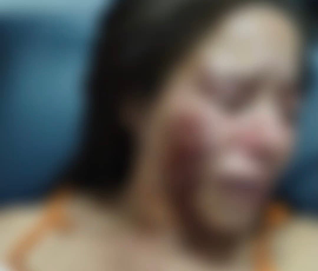 Mulher foge ensanguentada de cárcere privado, pede socorro e ex-companheiro é preso