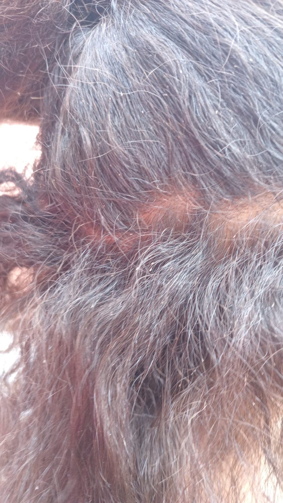 Babá é presa após deixar criança repleta de piolhos em casa usada por usuários de drogas
