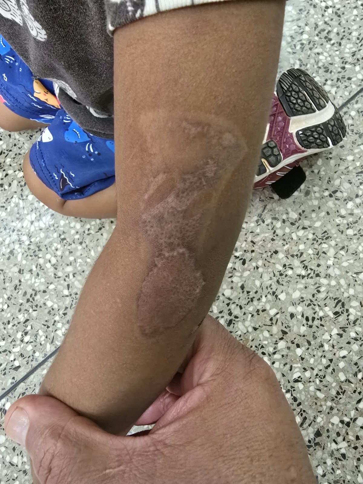 Mulher é presa em Aparecida após espancar a mãe e queimar filhos com ferro de passar