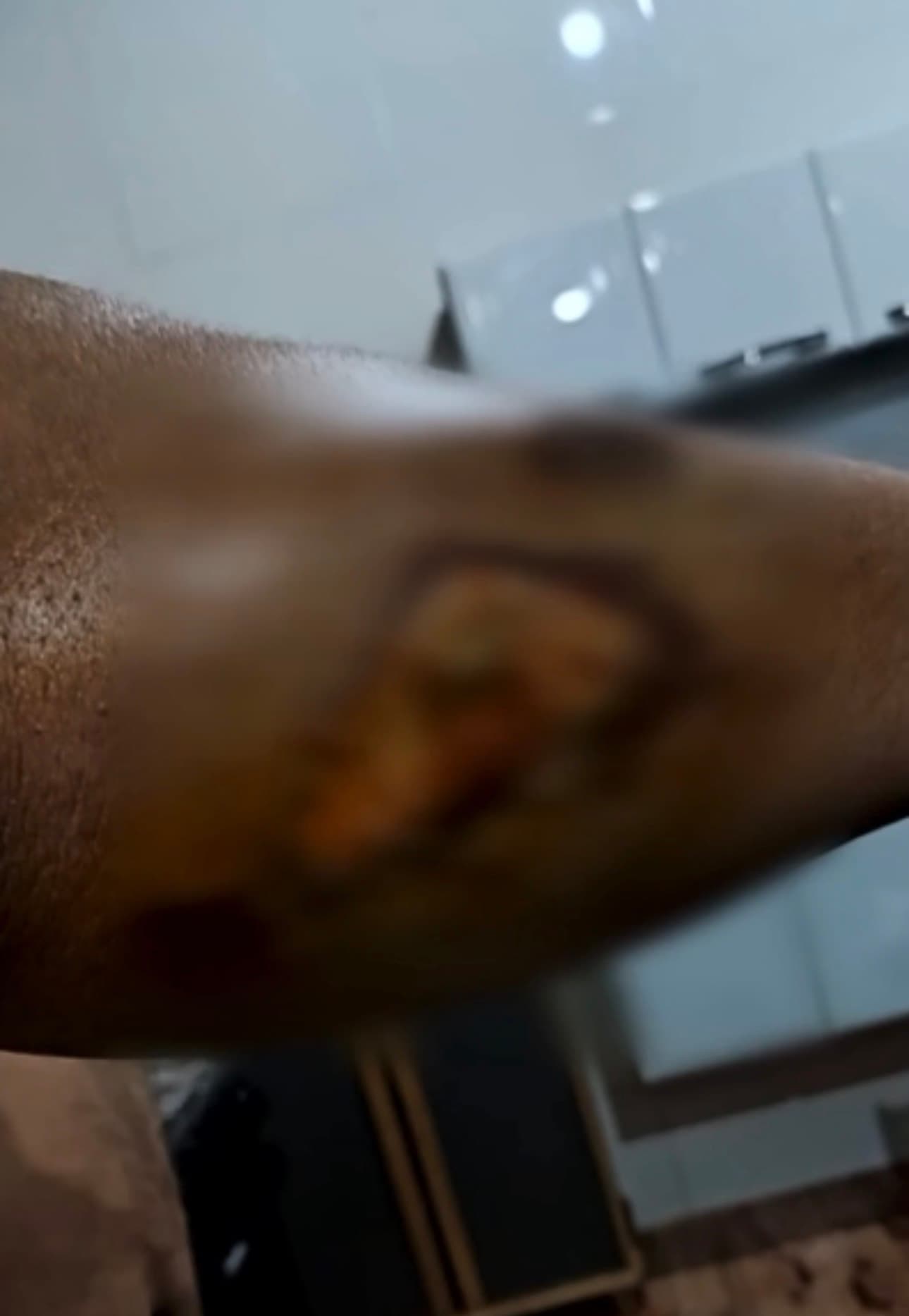 Fios soltos enrolam em pneu, causam queda de motociclista e deixam trabalhador ferido em Cristalina