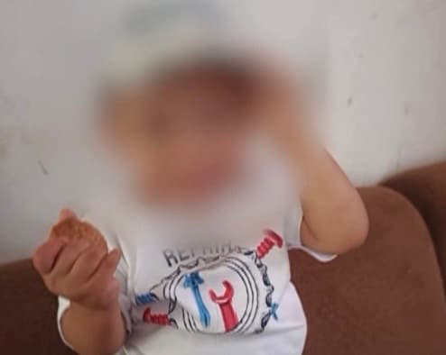 Criança tem 30% do corpo queimado em explosão de fogareiro a álcool; mãe fica ferida e desabafa sobre ataques