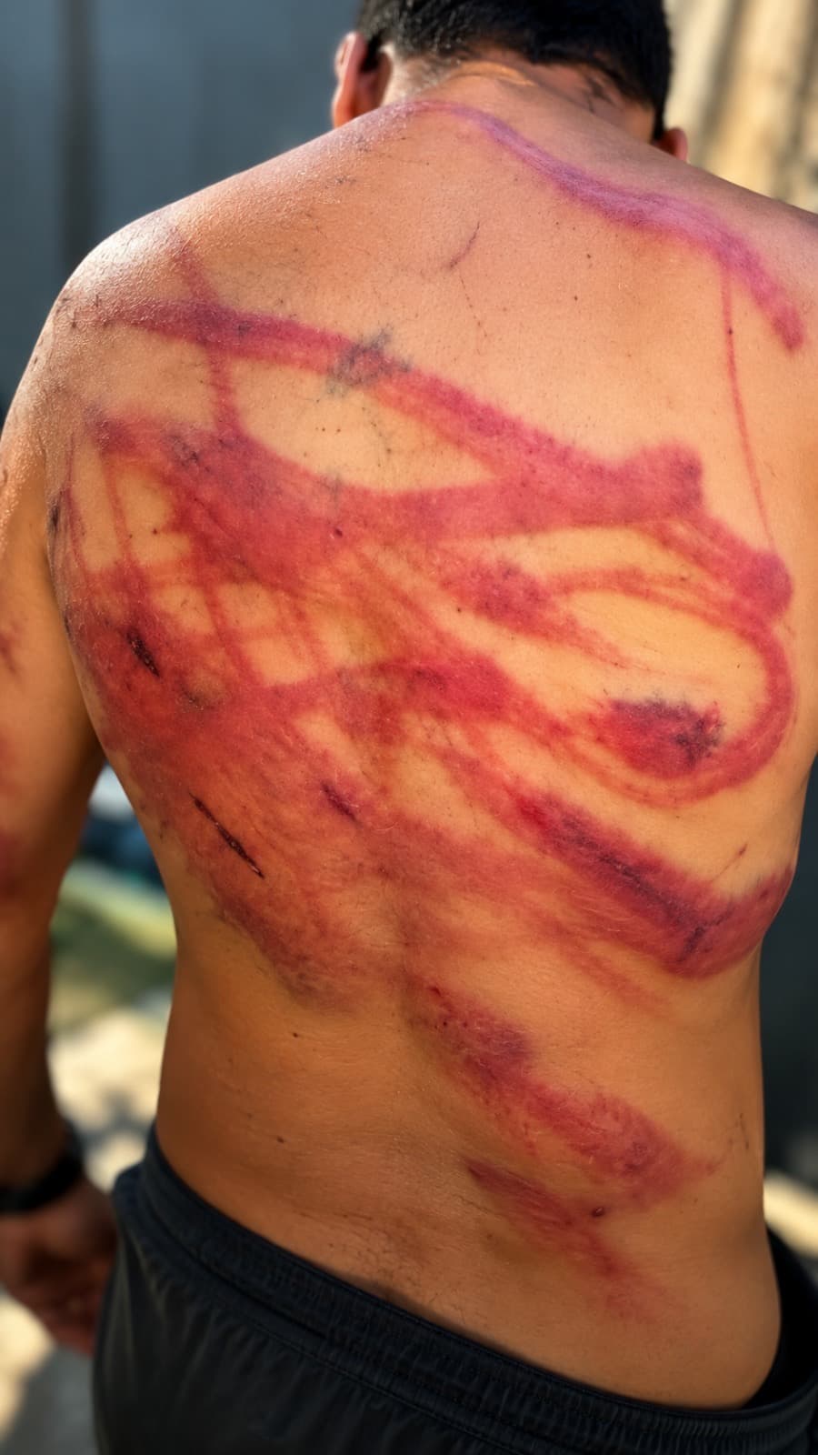 Homem dá tapa no rosto de mulher, leva paulada de populares e acaba preso por vandalismo