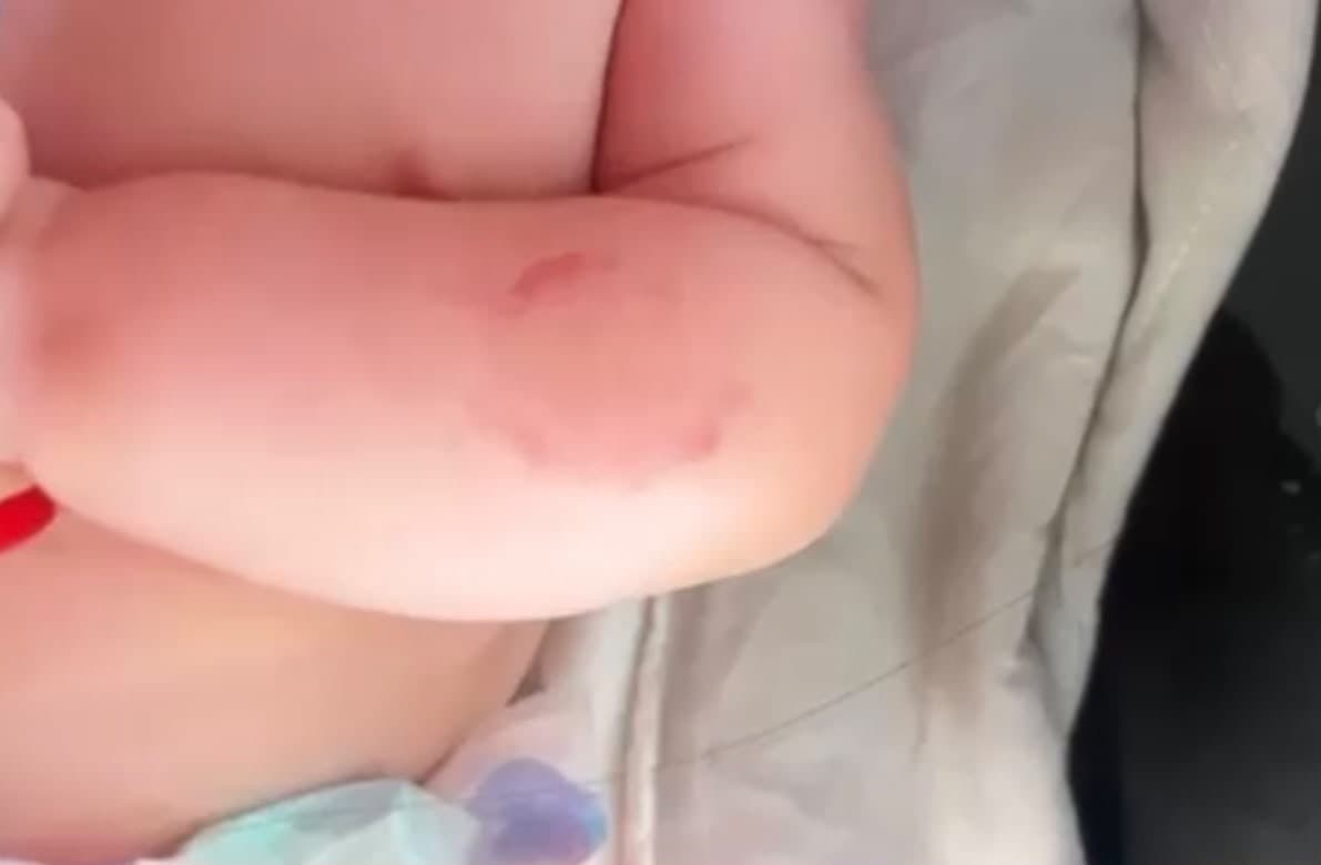 Homem é preso em flagrante por morder bebê de 4 meses e alegar "brincadeira"